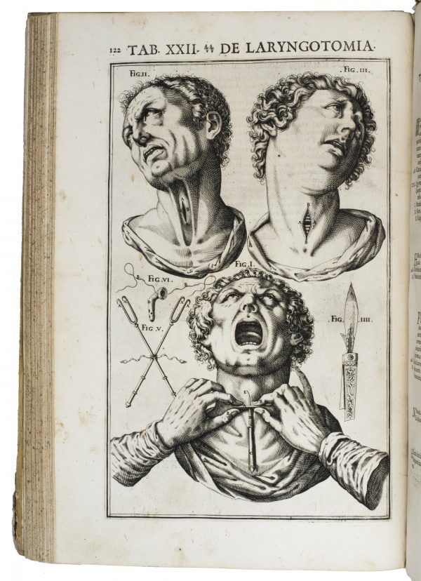 Beautifully illustrated first accurate monograph on the larynx, heavily influenced by Galen